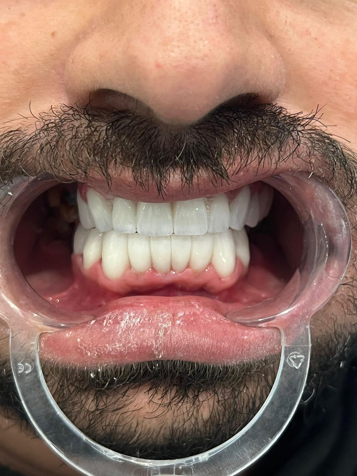 ECE Dental Patient Result