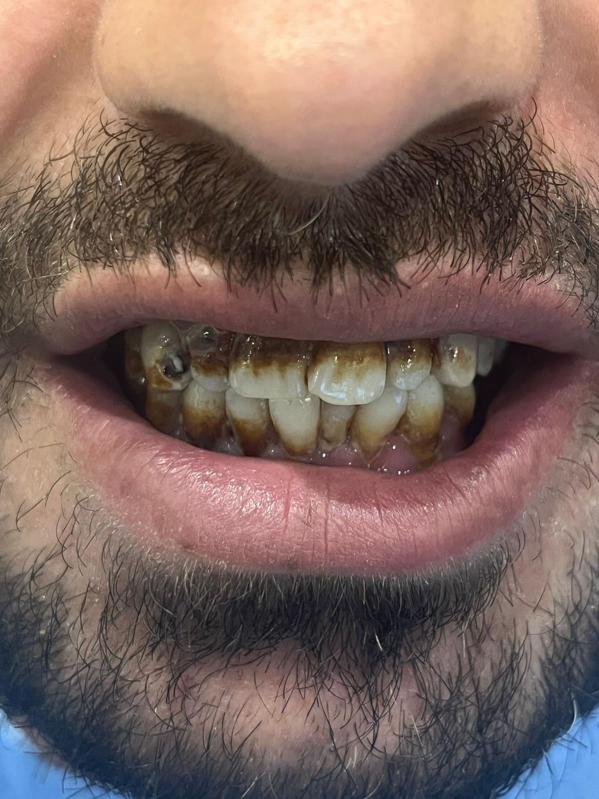 ECE Dental Patient Result